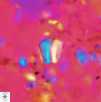 Conusphaera mexicana minor 1383
