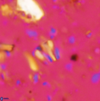 Conusphaera rothii minor 1404