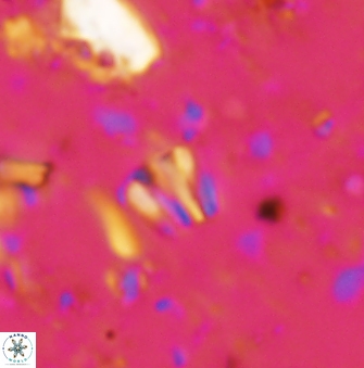 Conusphaera rothii minor 1404