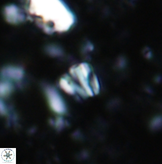 Conusphaera rothii minor 1405