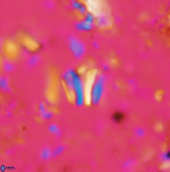 Conusphaera rothii minor 1402