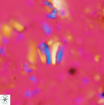 Conusphaera rothii minor 1402