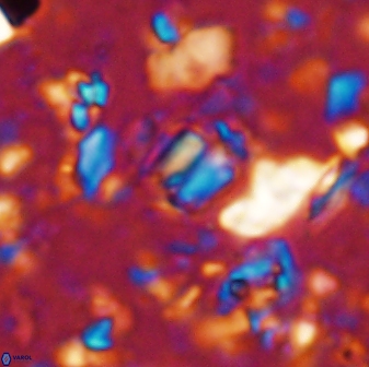 Conusphaera mexicana minor 33263