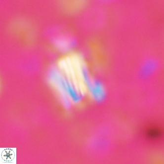 Conusphaera rothi rothii 1252