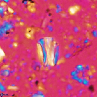 Conusphaera rothi rothii 1255