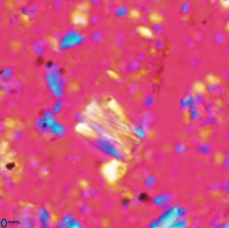 Conusphaera rothi rothii 1256