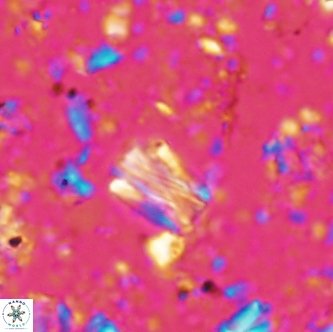 Conusphaera rothi rothii 1256