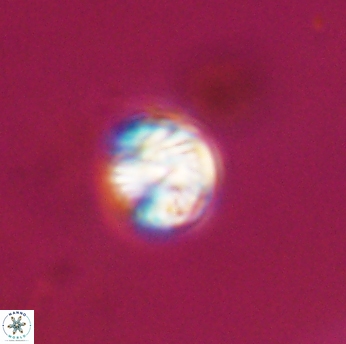 Conusphaera rothi rothii 19351