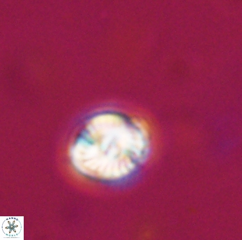 Conusphaera rothi rothii 19359