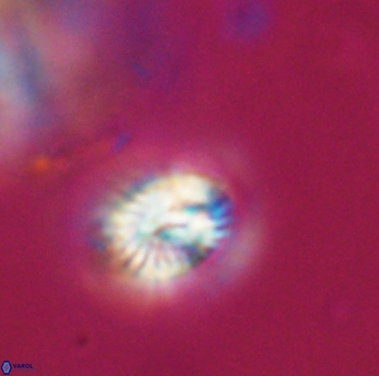 Conusphaera rothi rothii 19364