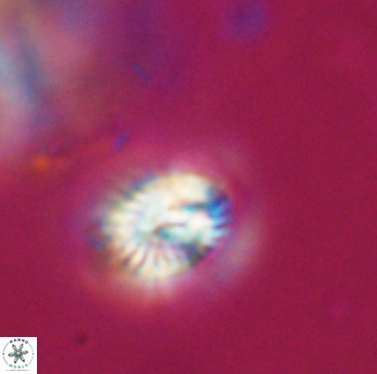 Conusphaera rothi rothii 19364