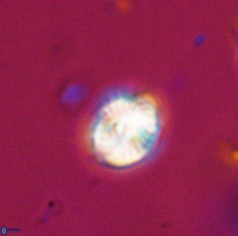 Conusphaera rothi rothii 19365