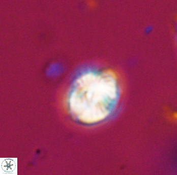 Conusphaera rothi rothii 19365