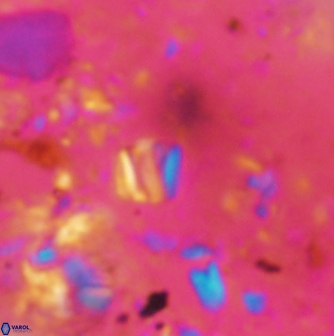 Conusphaera rothii minor 1373