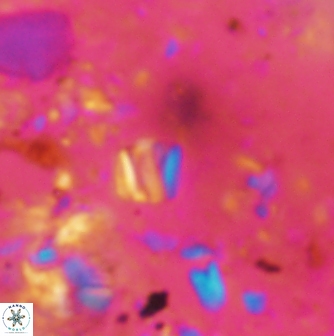 Conusphaera rothii minor 1373