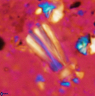 Conusphaera rothii rothii 1377