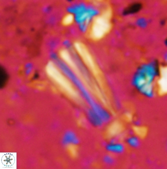 Conusphaera rothii rothii 1377