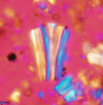 Conusphaera rothii rothii 1395