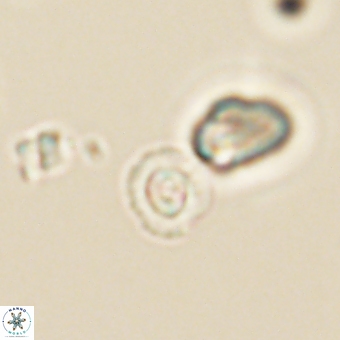 Coccolithus anulatus 68455