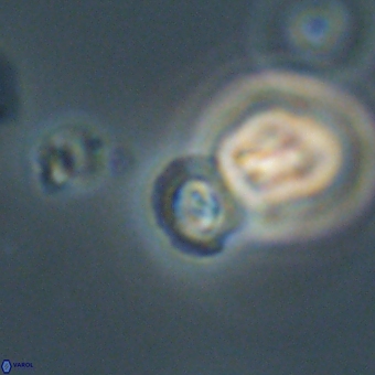 Coccolithus anulatus 68456