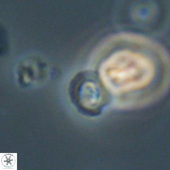 Coccolithus anulatus 68456