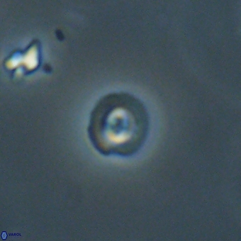 Coccolithus anulatus 68457