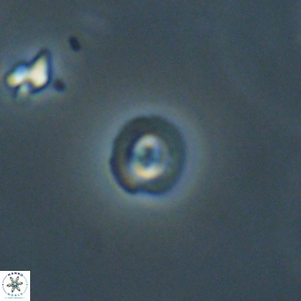 Coccolithus anulatus 68457