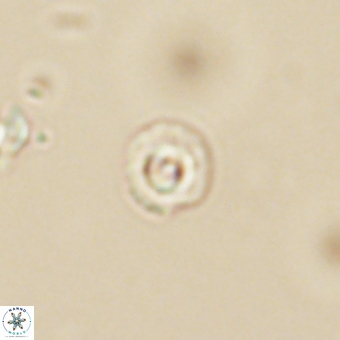 Coccolithus anulatus 68459