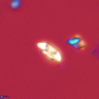 Coccolithus anulatus 68468