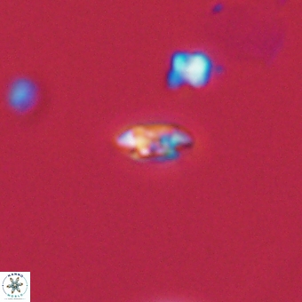Coccolithus anulatus 68475