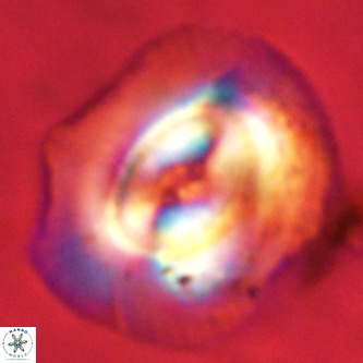 Coccolithus azorinus VR 02102