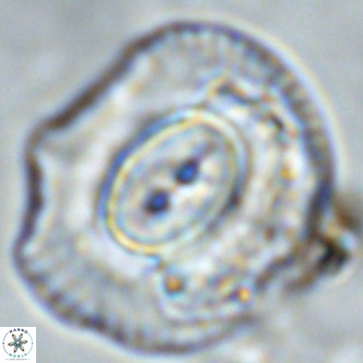 Coccolithus azorinus VR 02103