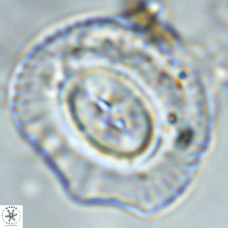 Coccolithus azorinus VR 02105