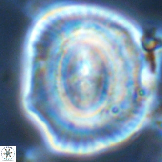 Coccolithus azorinus VR 02107