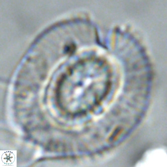 Coccolithus azorinus VR 02118