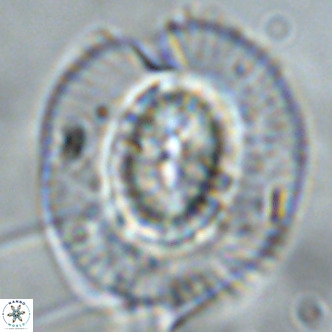 Coccolithus azorinus VR 02119
