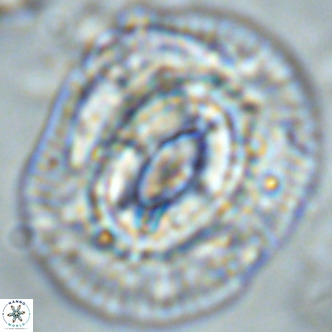Coccolithus azorinus VR 02215