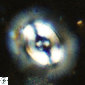 Coccolithus azorinus VR 10696