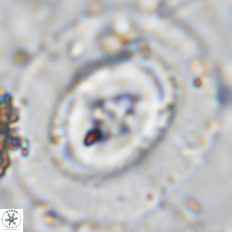 Coccolithus azorinus VR 10703