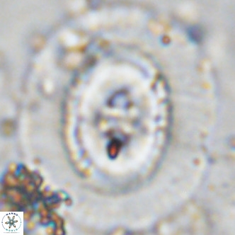 Coccolithus azorinus VR 10704