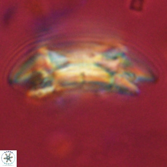 Coccolithus azorinus VR 10800