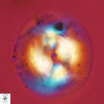Coccolithus azorinus VR 10824