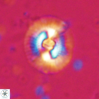 Coccolithus biparteoperculata VR 025527