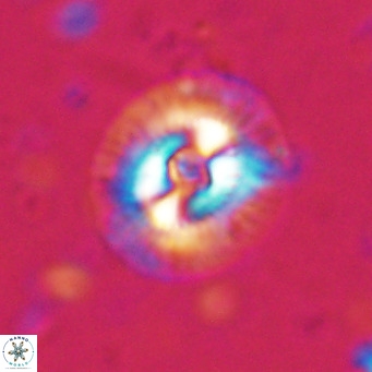 Coccolithus biparteoperculata VR 025528