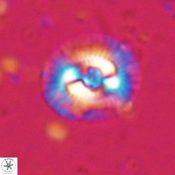 Coccolithus biparteoperculata VR 025531