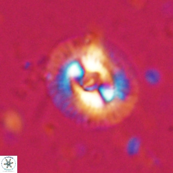 Coccolithus biparteoperculata VR 025533