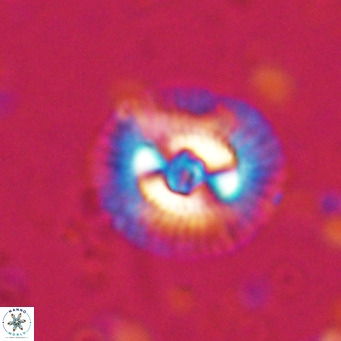 Coccolithus biparteoperculata VR 025535