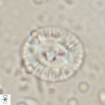 Coccolithus biparteoperculata VR 025536