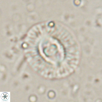Coccolithus biparteoperculata VR 025537