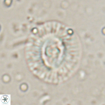 Coccolithus biparteoperculata VR 025538